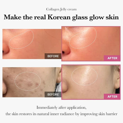 100g Jelly Face Cream Collagen Face Skin Care